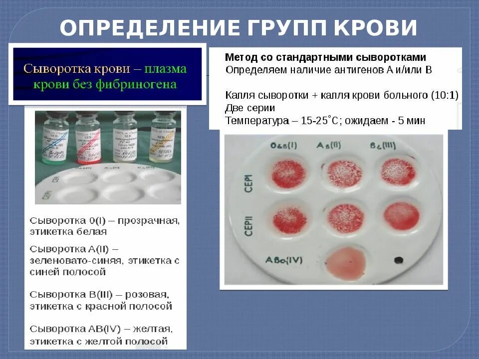 Резус фактор крови цоликлонами. Лабораторные методы определения группы-крови и резус-фактора. Цоликлоны для определения группы крови таблица. Резус фактор цоликлонами таблица. Метод определения стандартными сыворотками.