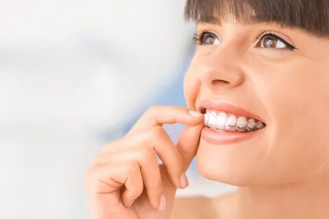 Invisalign Provider Cerritos Best Alternative to Adult Braces.