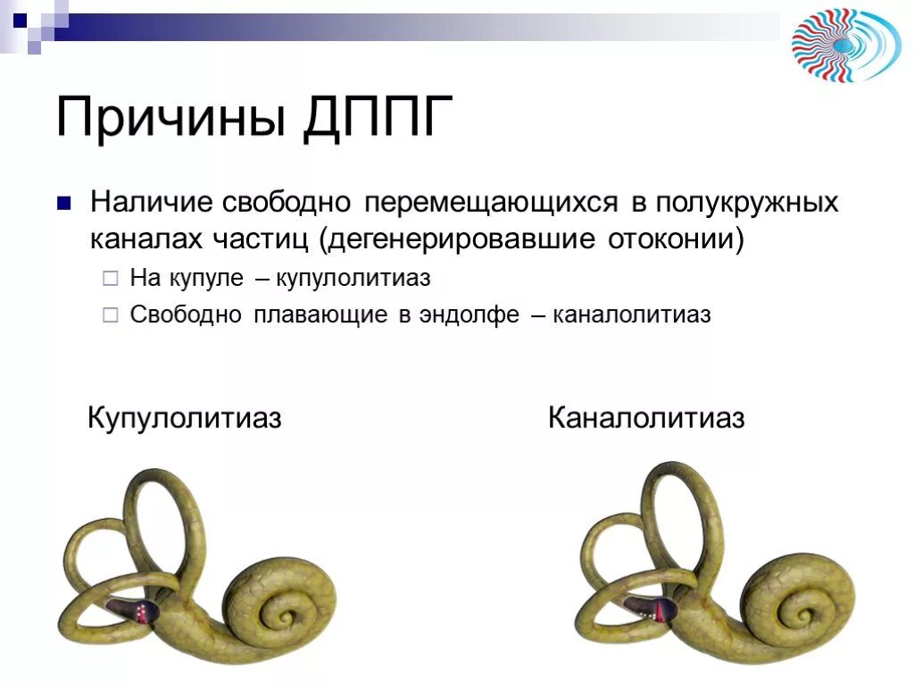 Дппг симптомы. Дппг. дппг купулолитиаз. дппг горизонтального полукружного. дппг заднего полукружного канала.
