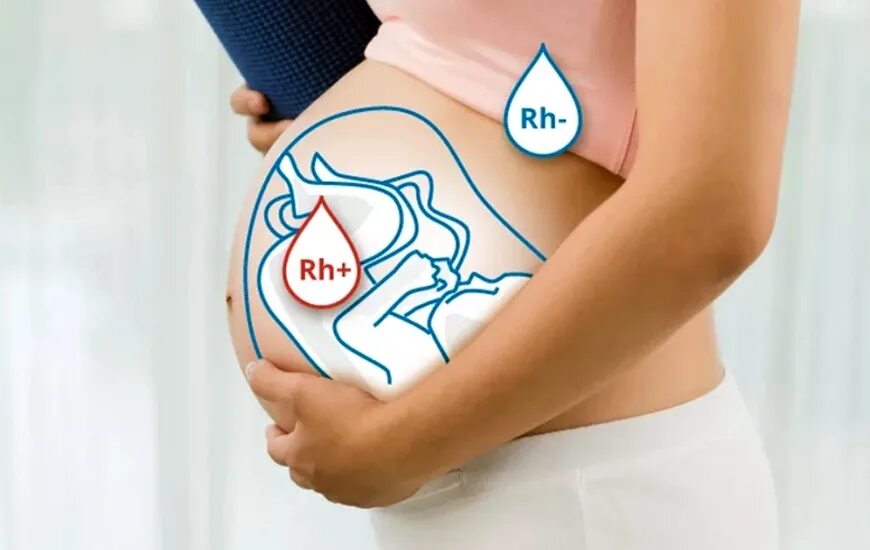 Забеременеть с резус отрицательной. Резус конфликт. Резус-конфликт при беременности. Несовместимость крови матери и плода. Резус конфликтная беременность.