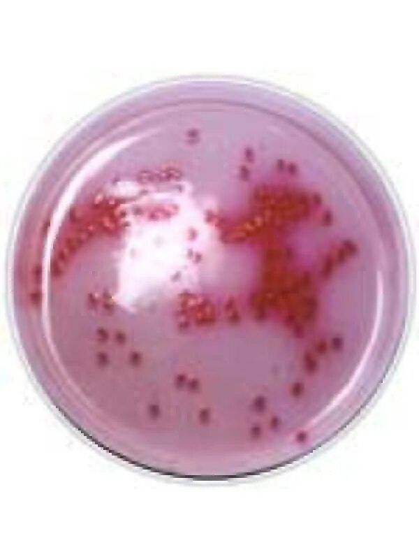 Эшерихии на среде эндо. Среда эндо лактозоположительные колонии. Эндо микробиология. Эндо микробиология. Среда эндо микробиология.