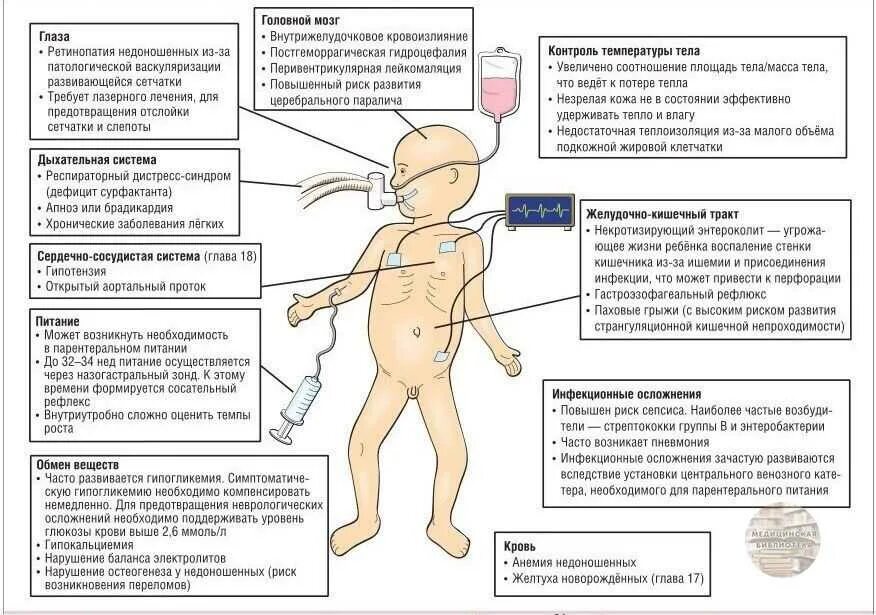 Недоношенный кровоизлияние. Последствия недоношенности. Последствия недоношенности ребенка. Внешние признаки недоношенности. Причины развития недоношенности.