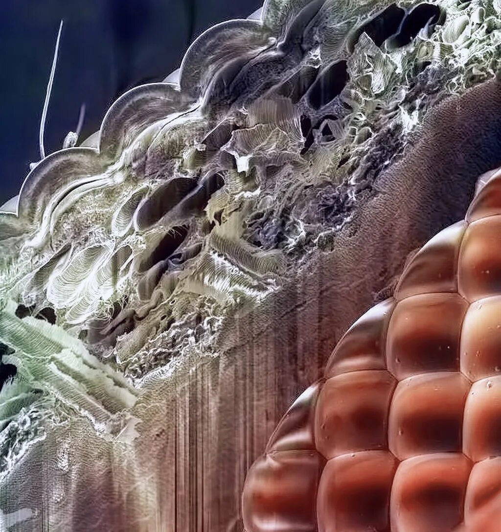 Бактерии на мухе. Демодекс под микроскопом. Объекты под микроскопом. Сок под микроскопом. Сигарета под микроскопом.