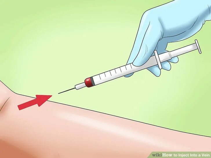 How to inject wave