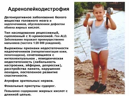 Болезнь мальчиков