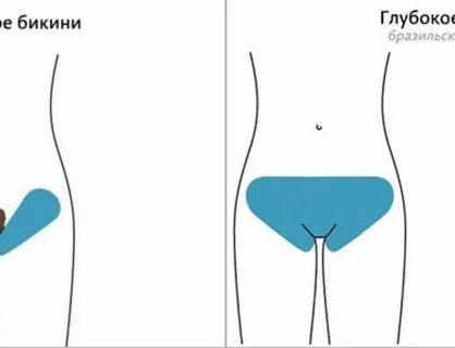 Само депиляция бикини