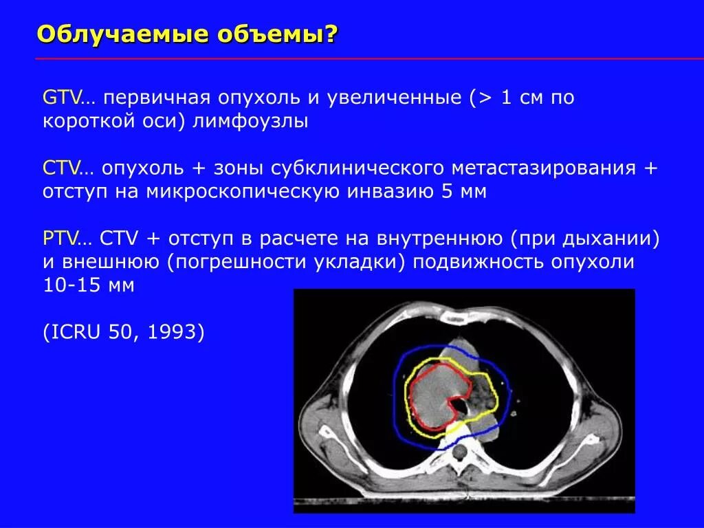 Короткая ось лимфоузла. GTV CTV PTV. GTV CTV PTV лучевая терапия. Измерение лимфоузлов по короткой оси.