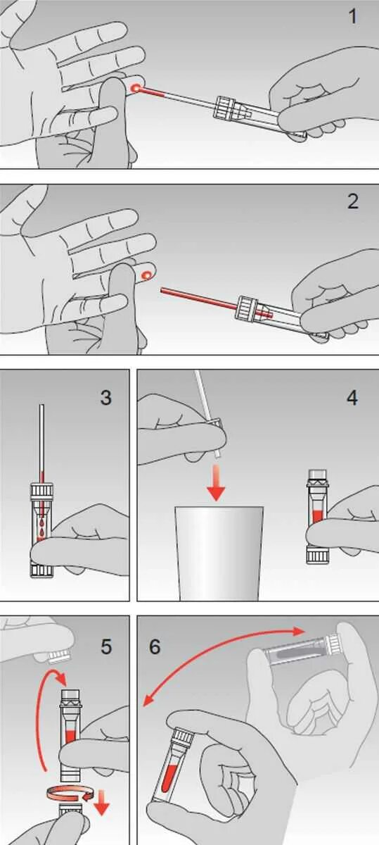 Как колоть палец. Техника взятия капиллярной крови из пальца. Алгоритм взятия капиллярной крови. Скарификаторы метод забора крови. Техника забора капиллярной крови из пальца.