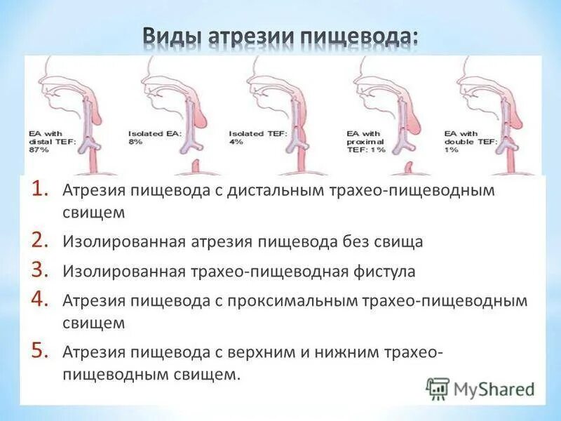 Отсутствие пищевода. Атрезия пищевода классификация. Анатомические формы атрезии пищевода. Атрезия пищевода причины. Врожденная атрезия пищевода.