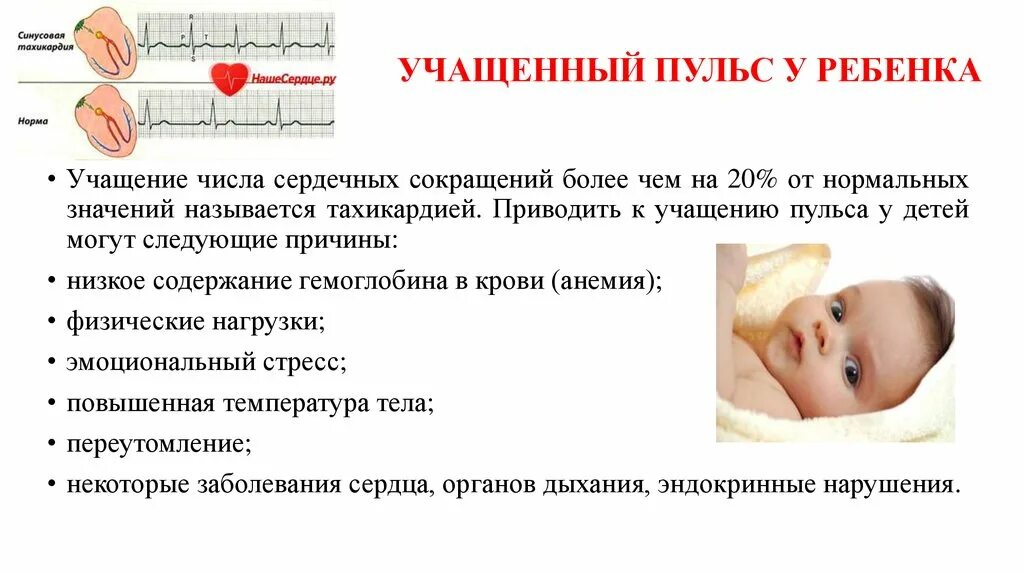 Сердцебиение повышено причины. Ущищенное сердцебиение у ребёнка. учащенный пульс у ребенка. учащеннвй пульс у ребёнка. причины учащенного пульса.
