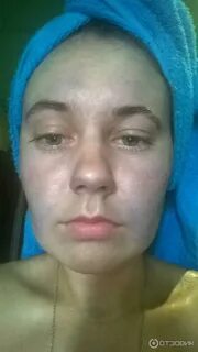 Синюшный оттенок лица