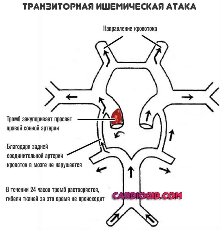 Правая задняя трифуркация. Виллизиев круг в головном мозге анатомия. Сегменты артерий Виллизиева круга. Внутренняя Сонная артерия Виллизиев круг. Незамкнутый Виллизиев круг мрт.