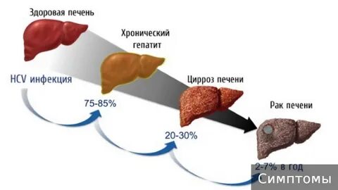 Гепатит у скольких людей
