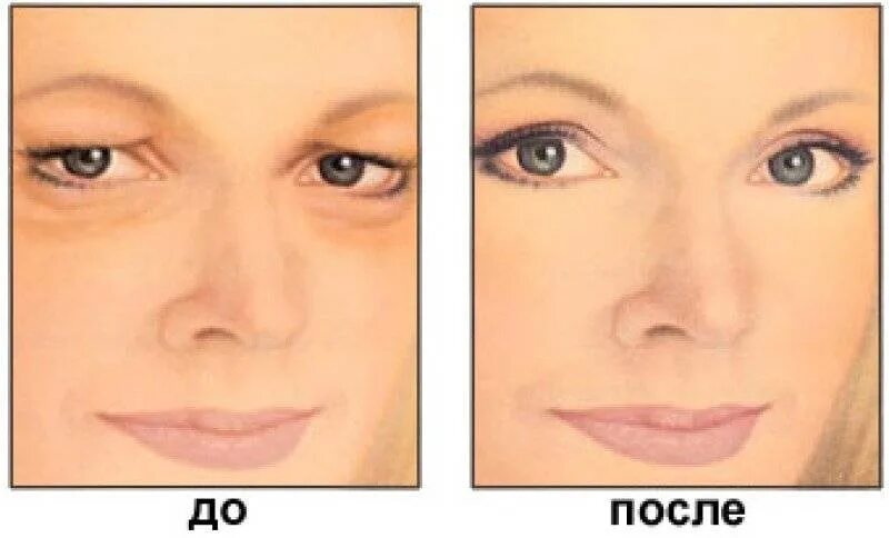 Как сохранить веки
