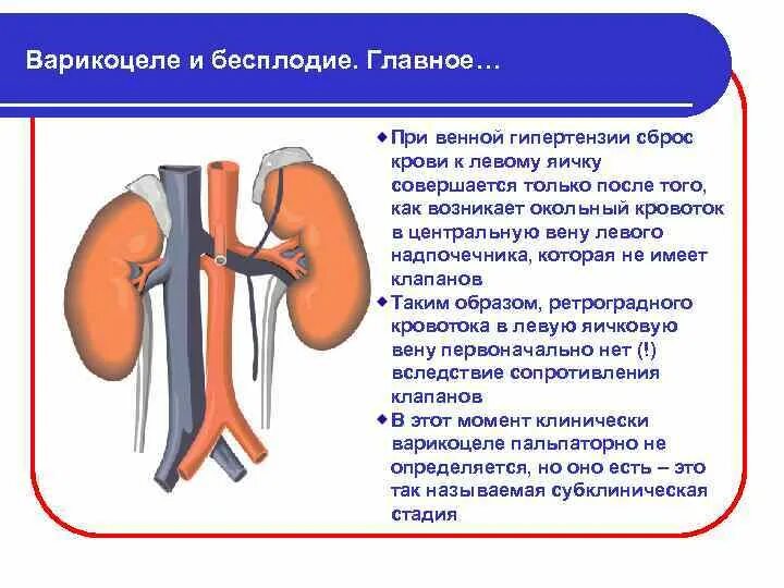 Расширение вен канатика. Варикоцеле механизм развития.