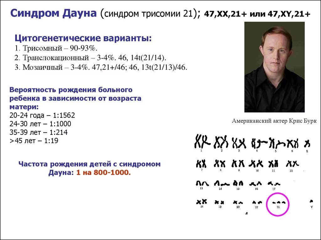 Варианты синдрома дауна