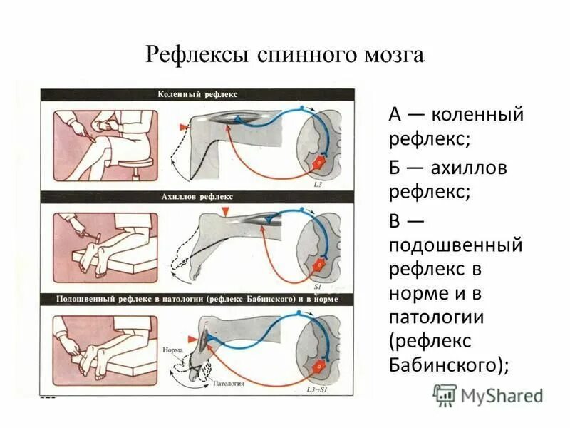 Проверка рефлексов. Коленный и Ахиллов рефлексы физиология. Ахиллов рефлекс схема рефлекторной дуги. Ахиллов рефлекс подошвенный рефлекс. Ахиллов рефлекс в норме.