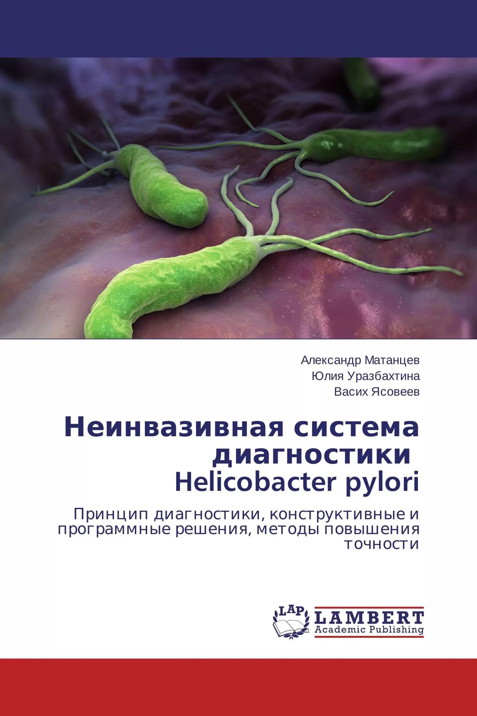 Хеликобактер пилори погибает. Штаммы хеликобактер пилори. Хеликобактер пилори препараты.