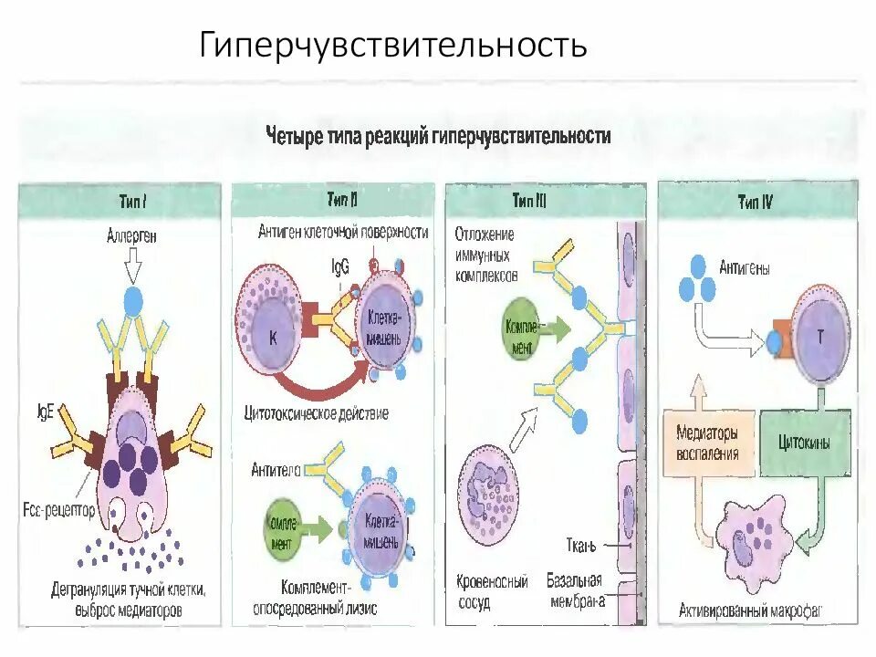 Иммунная гиперчувствительность. Схема реакции гиперчувствительности 1 типа. Схема гиперчувствительности немедленного типа. Реакция гиперчувствительность 4 типа. Схема реакции гиперчувствительности 3 типа.