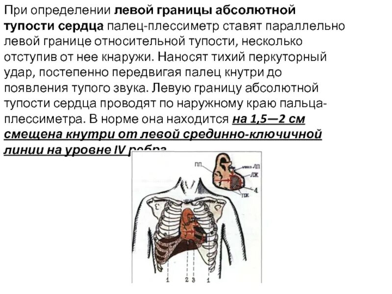 Сердечная тупость. Смещение верхней границы относительной сердечной тупости. Границы абсолютной тупости сердца. Левая граница относительной сердечной тупости определяется:. Левая граница сердца определяется.