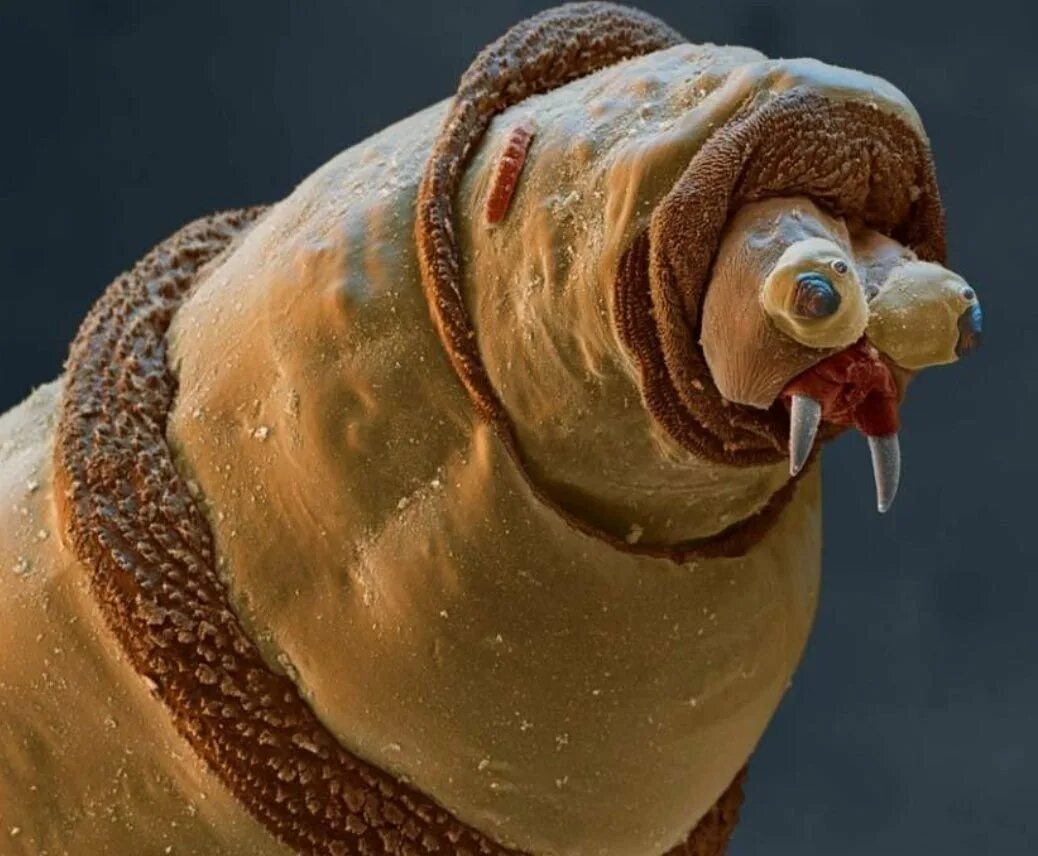 Дождевой червь под микроскопом. Микрофотография дождевого червя. Есть ли у червяков