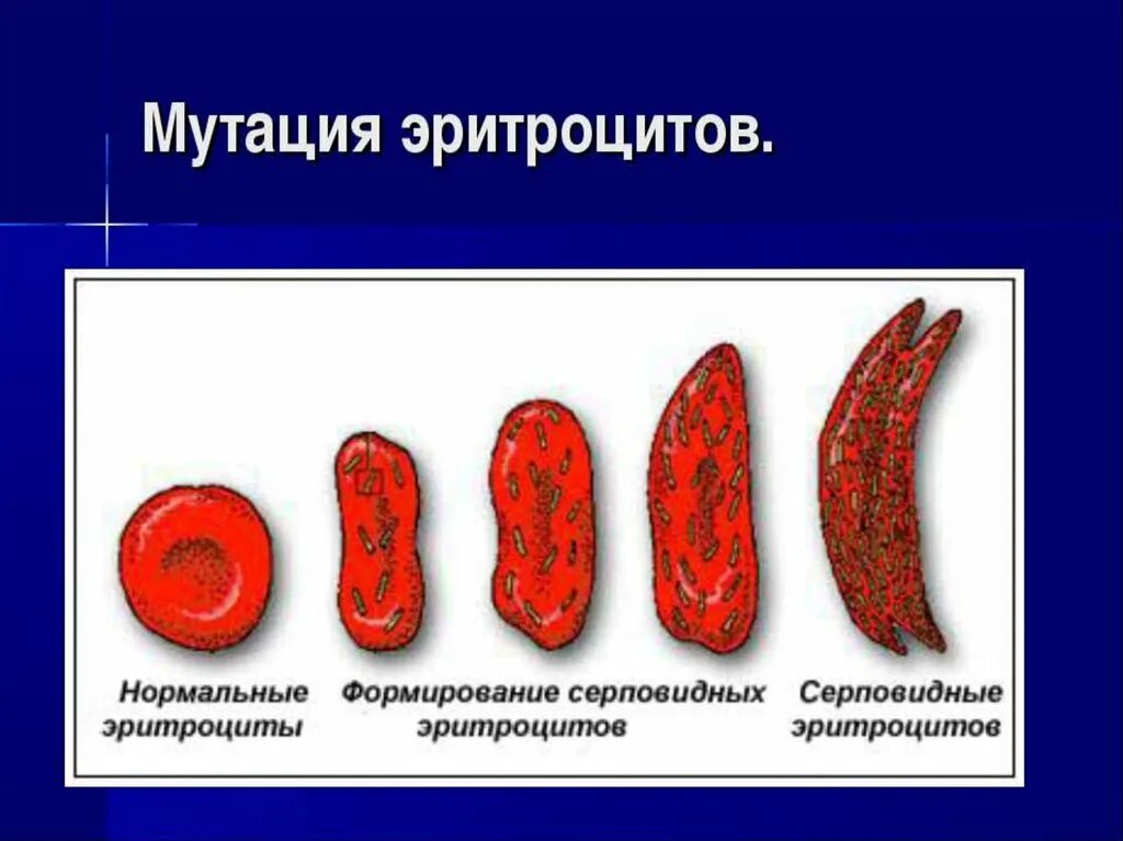 Серповидные эритроциты. Серповидноклеточная анемия эритроциты. эритроциты серповидной формы. серповидноклеточная анемия мутация. серповидные эритроциты и малярия.