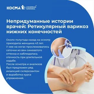 Ретикулярный варикоз нижних конечностей фото 