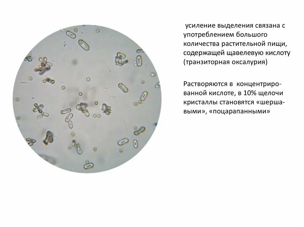 Исследование осадка мочи. Микроскопия мочи. Осадки мочи микроскопия.