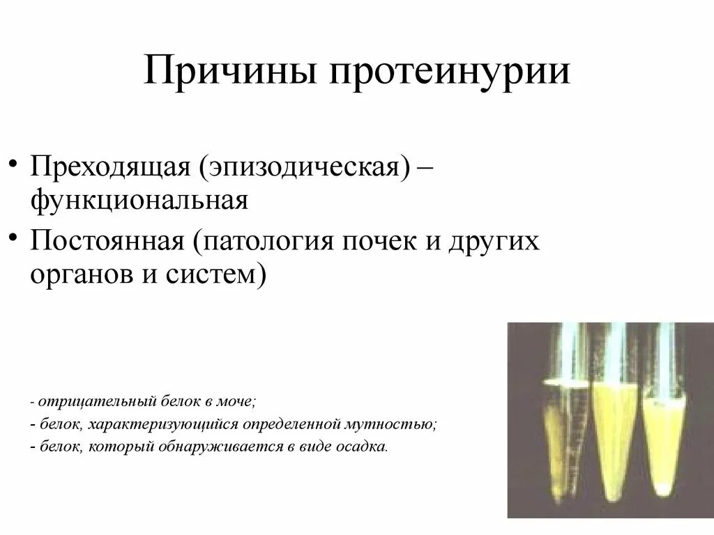 Моча при протеинурии внешний вид. Классификация протеинурии по количеству белка в моче. Причины функциональной протеинурии. Белок в моче причины.