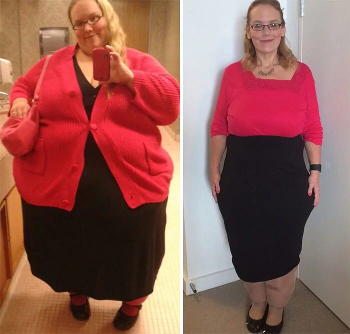 Она сильно похудела. Похудение до и после. До и после похудения женщины. Преображение людей до и после похудения.