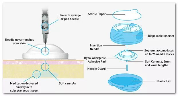 Устройство для введения инсулина. Инъекционный порт IPORT Advance. Порт для ввода инсулина. Катетер для введения инсулина. Инъекционный порт для инсулина.