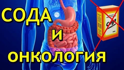 Рак лечение сода отзывы