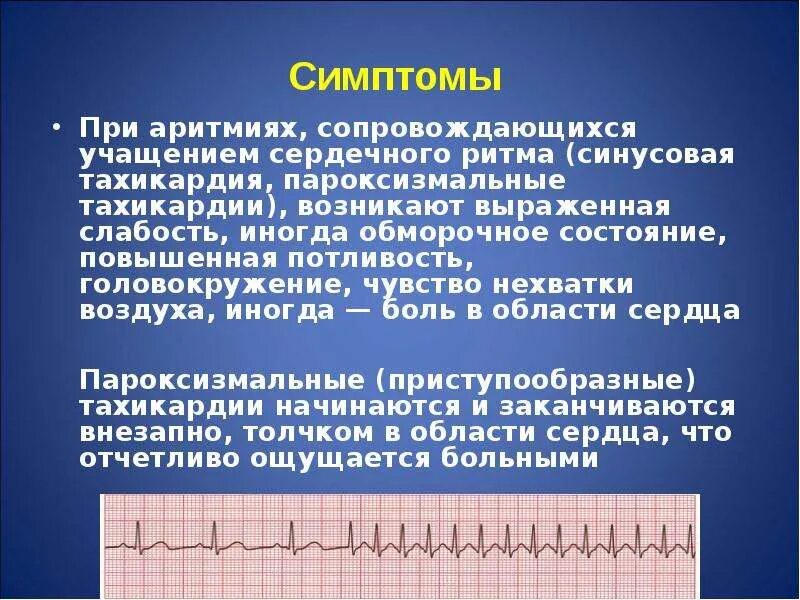 Синусовая тахикардия симптомы. Синусовая аритмия. Синусовая аритмия сердца. Нарушение сердечного ритма синусовая тахикардия.