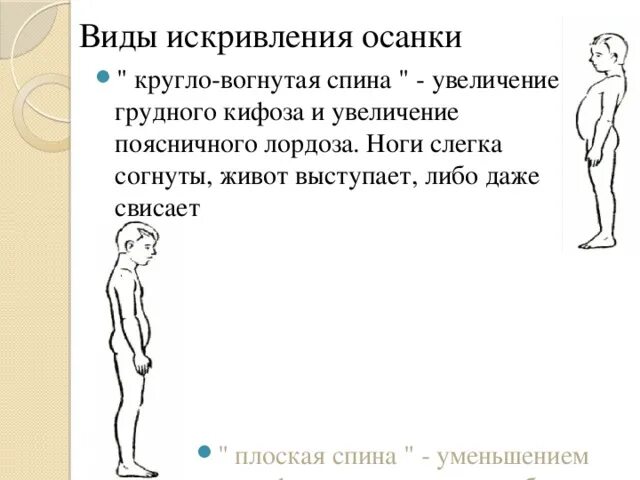 Тип осанки сутулая спина. Круглая спина у ребенка. Нормальная осанка. Кругло вогнутая осанка. Нарушение осанки круглая спина.