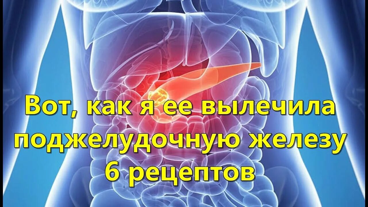 Полностью вылечил панкреатит. Как полечить поджелудочную. Поджелудочная вылечил. Как лечить под желудачную. Вылечить панкреатит навсегда.