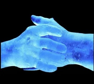 Cold hands