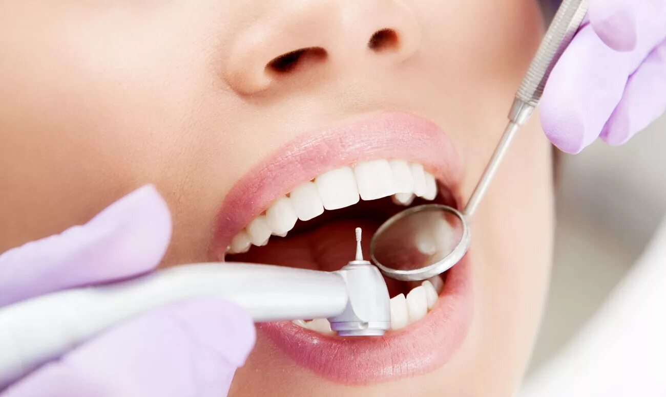 Профгигиена полости рта. Зубы стоматология. Терапевтическая стоматология. Терапия стоматология.