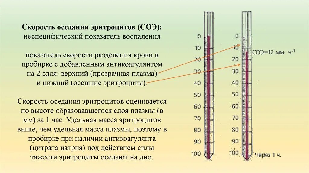 Соэ в крови по панченкову. Метод Панченкова СОЭ. Методика измерения СОЭ В крови. Оценка скорости оседания эритроцитов (СОЭ).. Исследование скорости оседания эритроцитов по Панченкову.