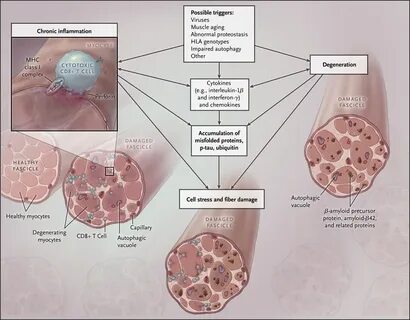 Myositis латынь
