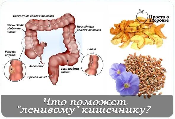 Проявление ленивого кишечника. Синдром ленивого кишечника.