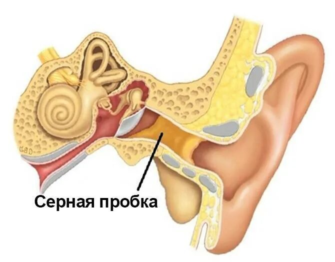 Как вытащить пробку у ребенка