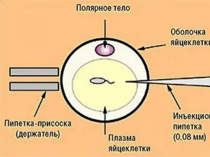 Чем отличается эко