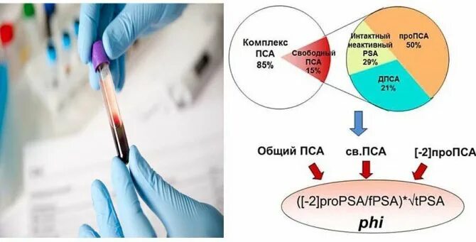 Анализ здоровье простаты. Пса индекс здоровья простаты. Индекс здоровья простаты phi. Индекс здоровья простаты показатели нормы. Phi индекс здоровья простаты анализ.