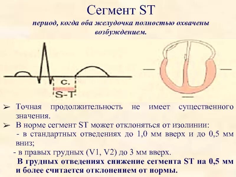 Сегмент s t. Сегмент ст на экг в норме. сегмент st на экг в норме. сегмент st на экг на изолинии. сегмент st на экг длительность.