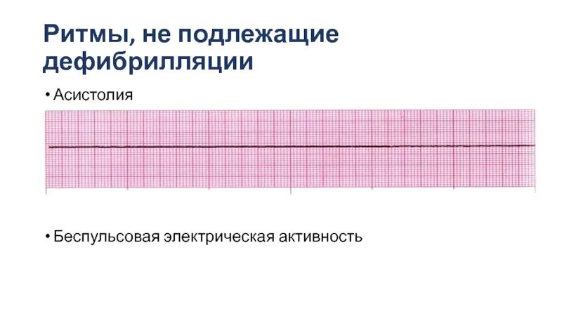 Асистолия. Вторичная асистолия это. Асистолия предсердий на ЭКГ. Асистолия желудочков на ЭКГ. Асистолия сердца это