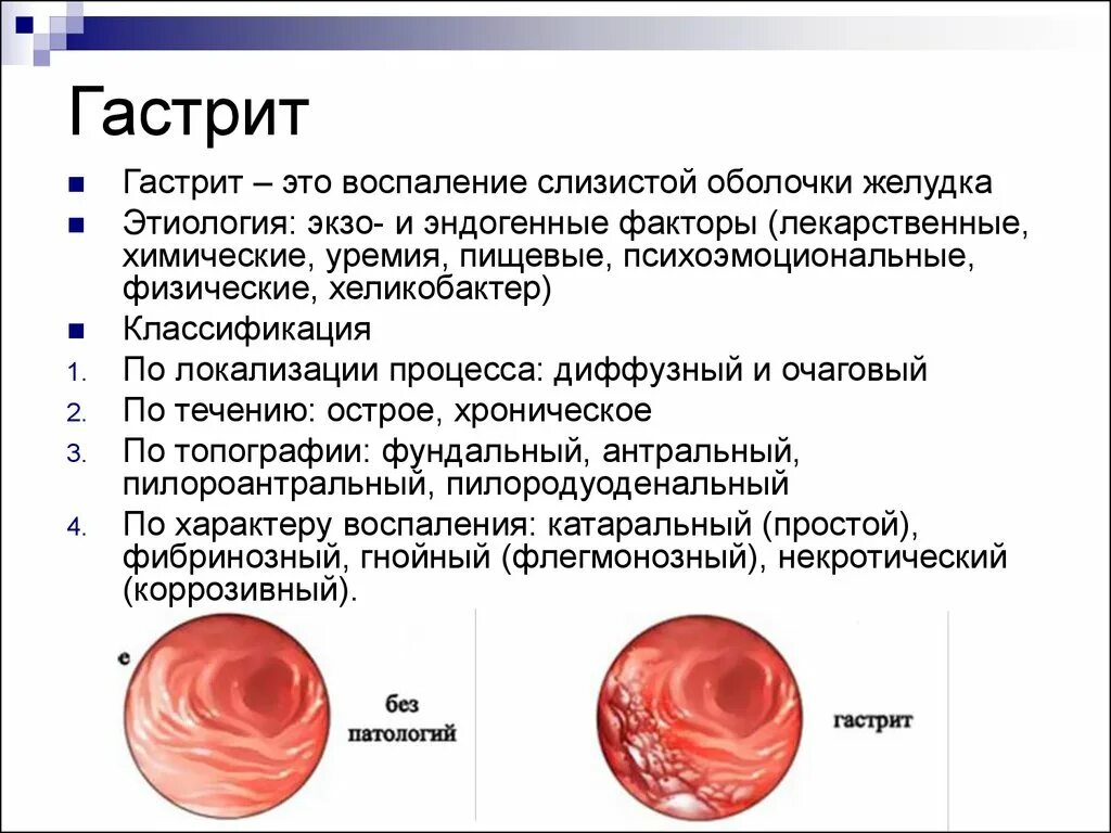 Воспаление слизистой оболочки. Характер воспалительного процесса при гастрите. Воспаление слизистой оболочки желудка. Боль при хроническом гастрите