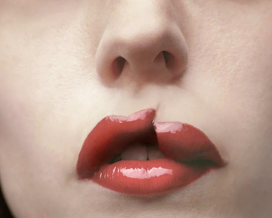 Рву губы. Гиповитамизной хейлит. Гиповитаминозный хейлит. Фото губ. Гиповитамизной хейлит.