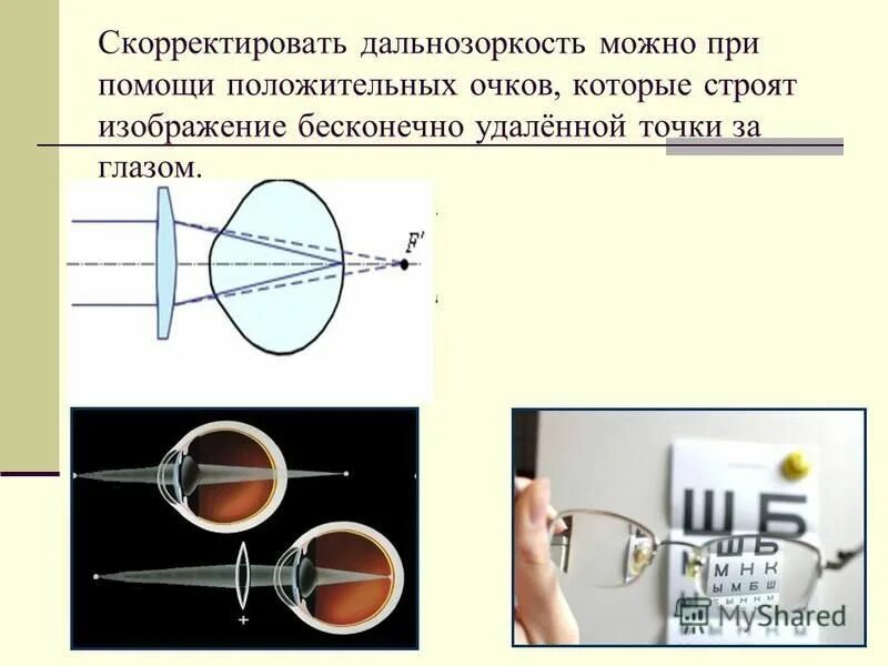 Как можно скорректировать дальнозоркость