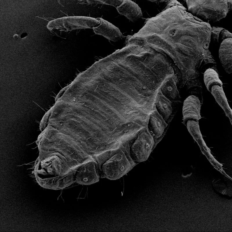 Вошь под микроскопом. Микропрепарат гниды вши. Как выглядят вши под. Как выглядят вши под. Гниды вшей под микроскопом.