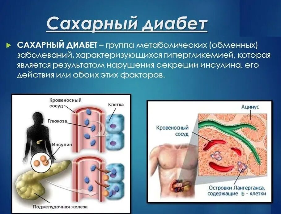 Сахарный диабет группа заболеваний. Сахарный диабет. Сохрани диабет. Болезнь сахарный диабет. Сахарный диабет картинки.